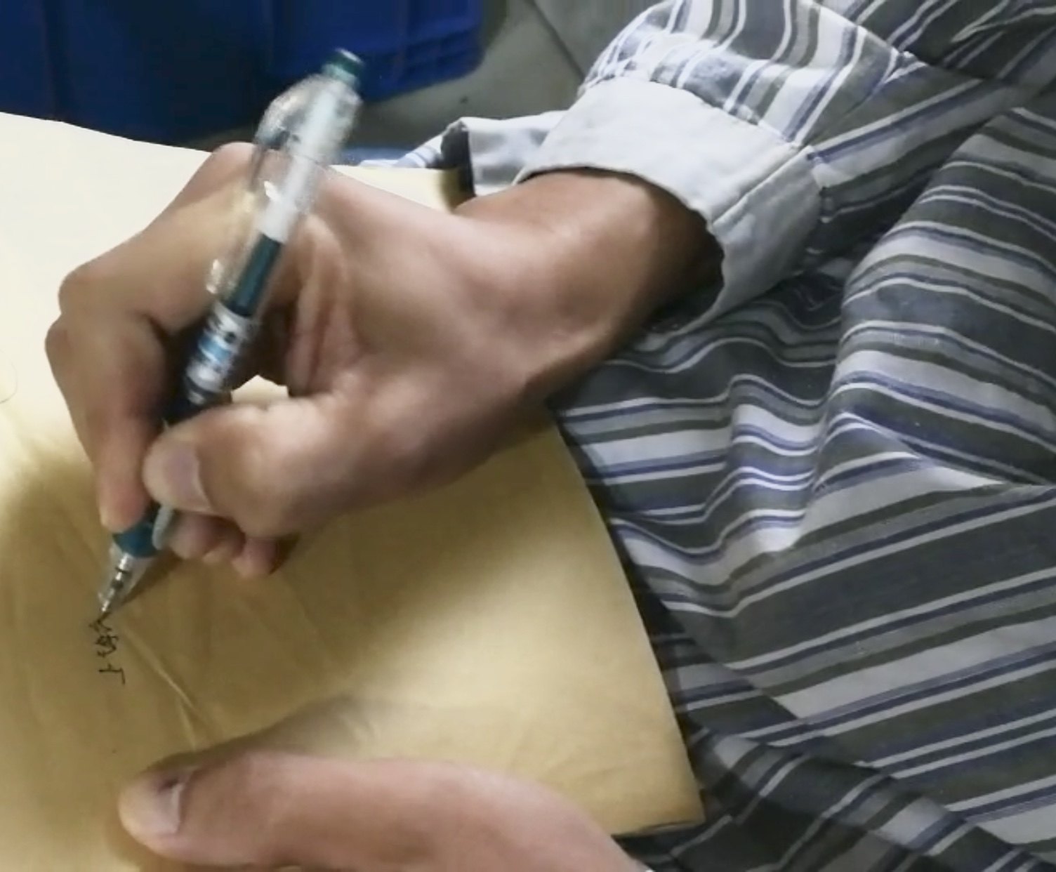 立体定向微创手术治疗书写痉挛 - 好大夫在线