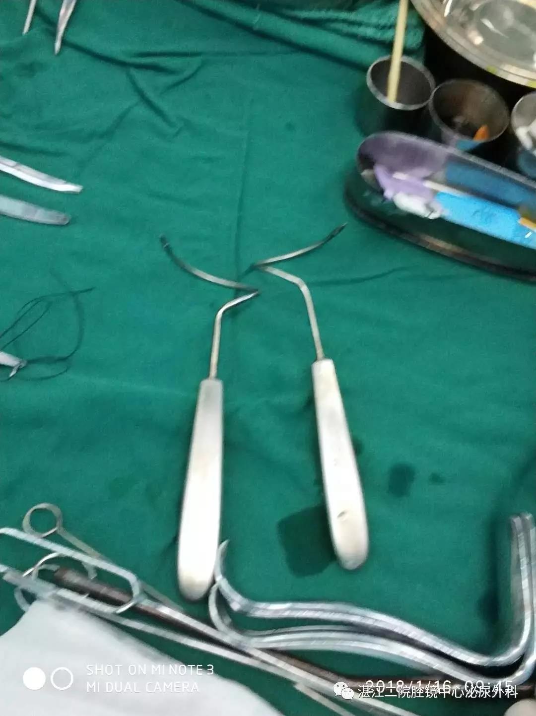 尿失禁吊带手术图片图片