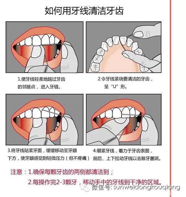 如何正确使用牙线? 