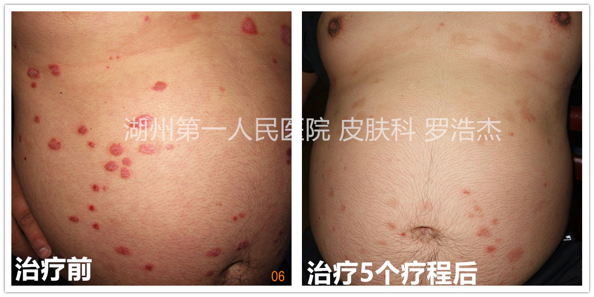 包含友谊医院代挂专家号服务出院手续全程代办,顺利结束疗程的词条 包含友谊医院代挂专家号服务出院手续全程代办,顺利结束疗程的词条