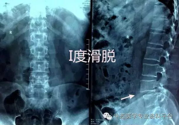 暂无