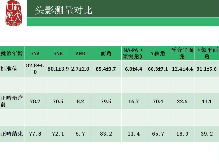 颞下颌关节相关正畸治疗二:骨关节病伴安氏一类开合病例 - 好大夫在线