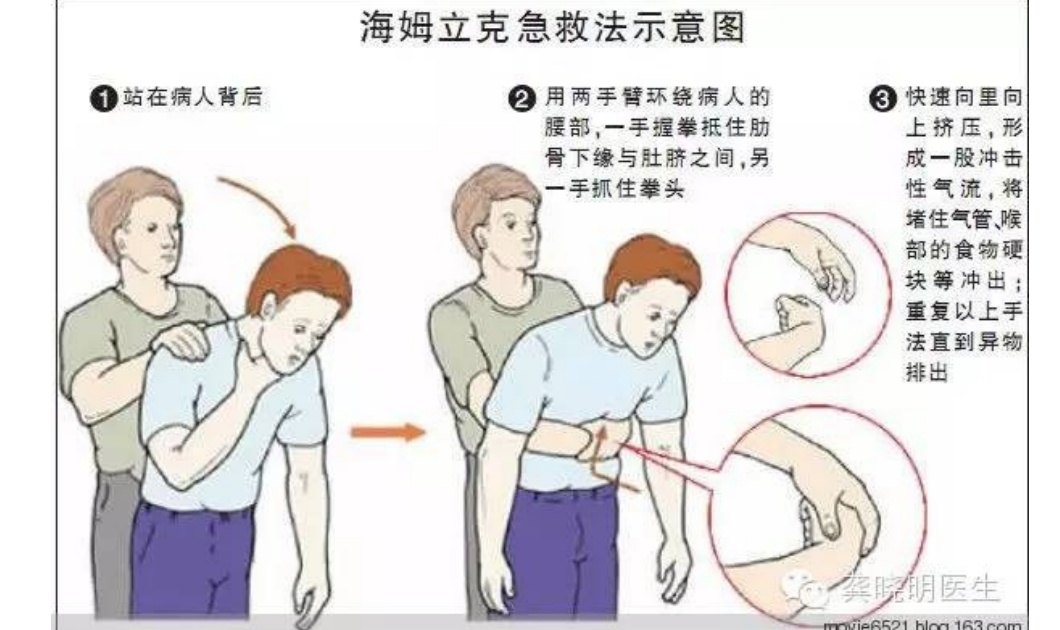 关于异物气道阻塞基本抢救