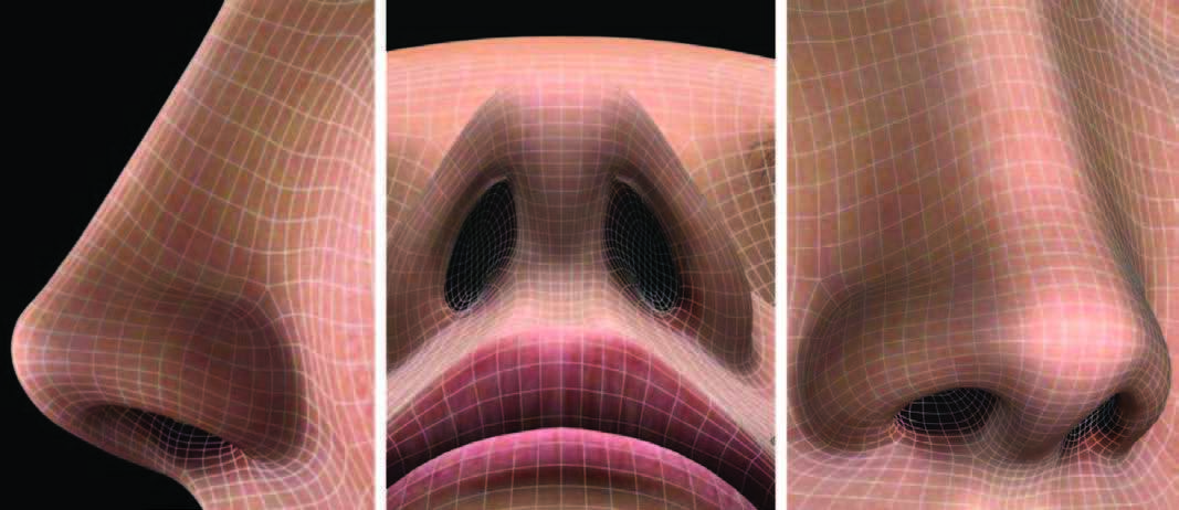 鼻整形师徒对话109鼻孔的形态鼻整形塑形的难点三