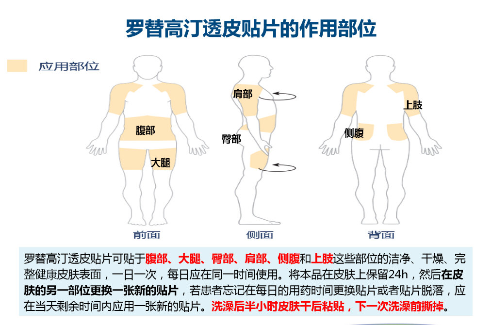 电疗贴片位置图图片