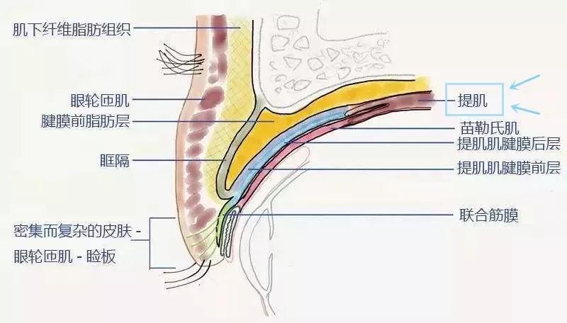 上睑下垂的眼睛不做上睑提肌等于白做