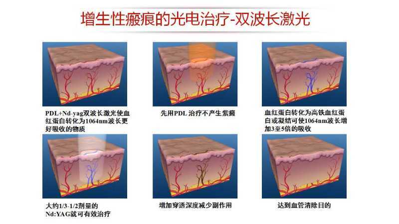 怎么才能做假伤口 yIYBAFwTw8SATqL3AACO4BaoR8I449.jpg?_ms_=037b