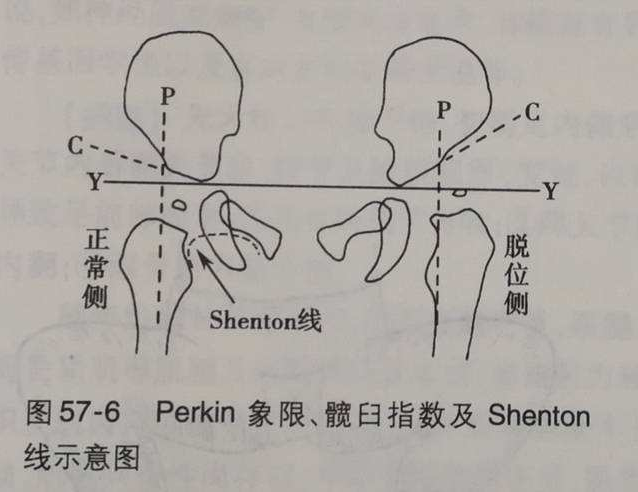 应该如何诊治?