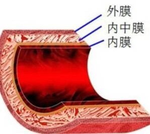 内膜:单层上皮细胞,又称"血管内皮".