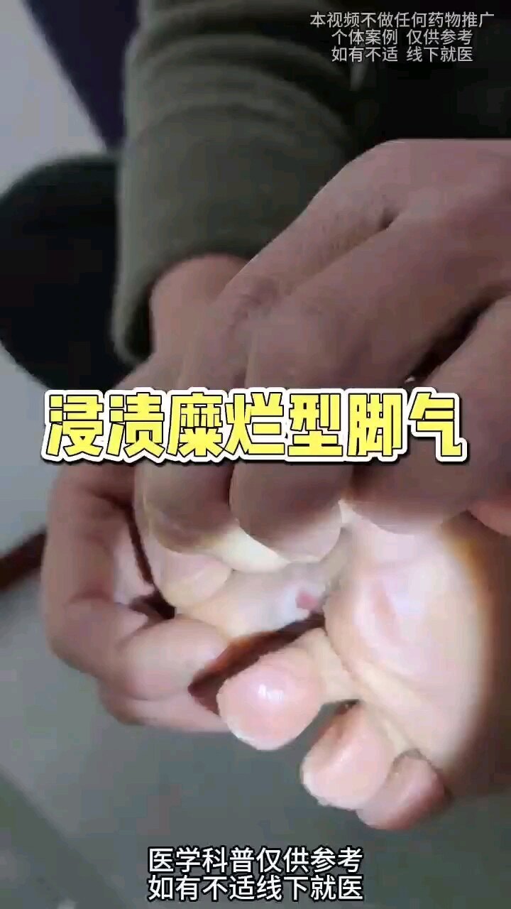視頻封面