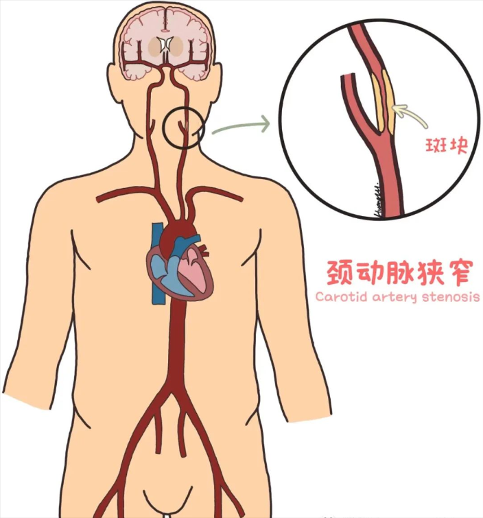 圖文圖片