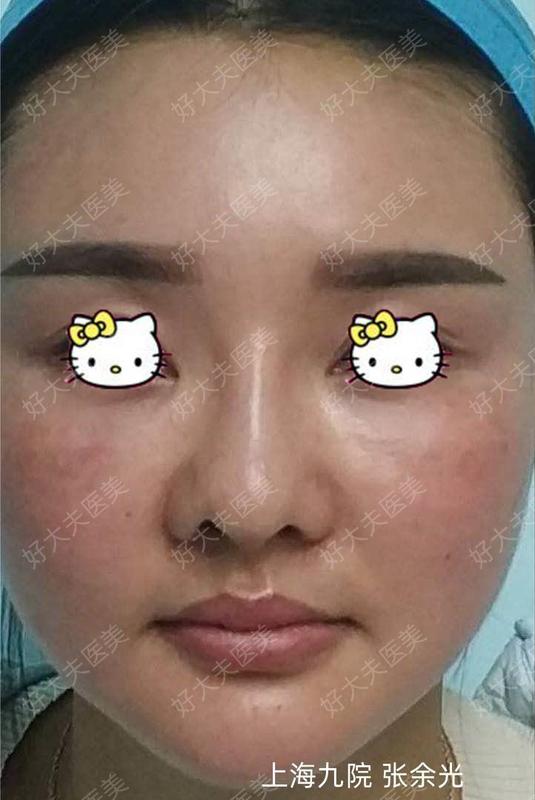 圖文圖片