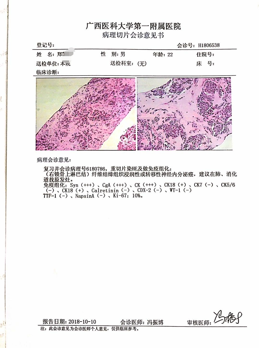 神经内分泌肿瘤的中医疗效