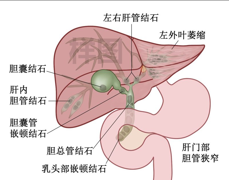 圖文圖片