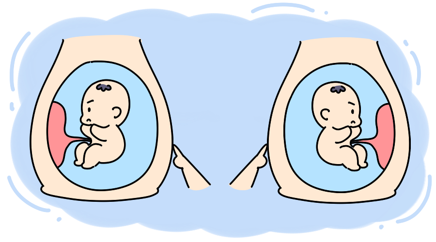 孕期发现宝宝患马蹄内翻足怎么办