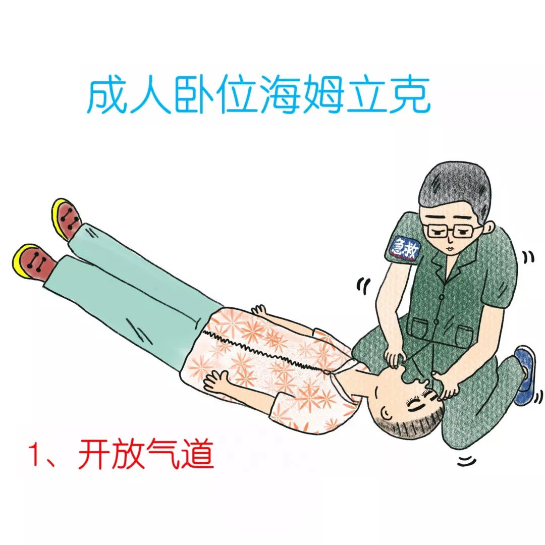 海姆立克腹部冲击法(heimlich maneuver)也称为海氏手技,是美国医生