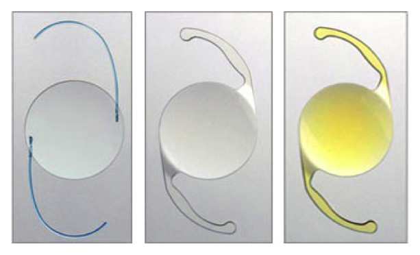 人工晶体的前世今生_晶状体病_晶状体病治疗方式 - 好大夫在线