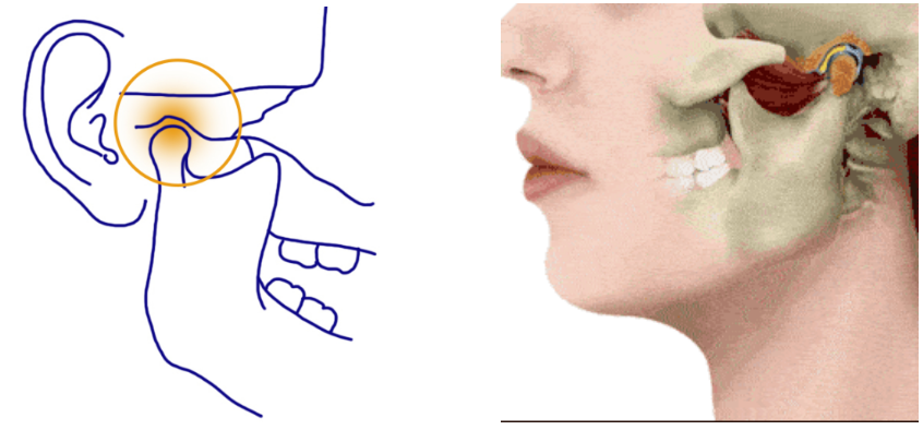 带你认识颞下颌关节紊乱综合征