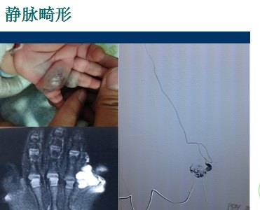 暂无