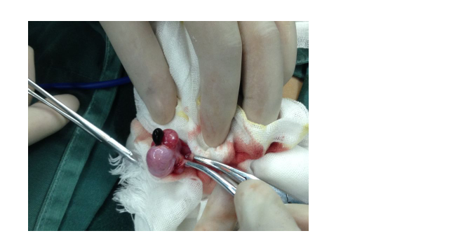 1例睾丸附件扭转的报道 - 好大夫在线