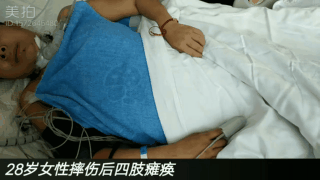 1540201048578641.gif 治疗前.gif