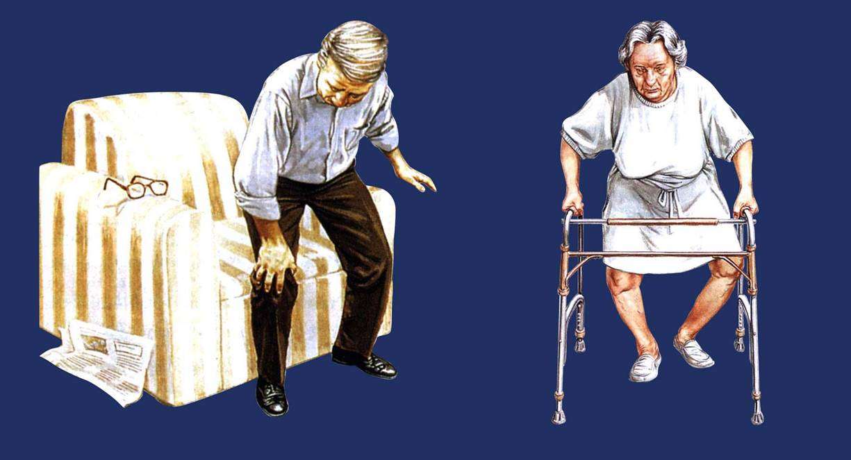 骨关节病及其治疗