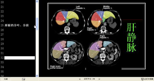肝脏分段8段CT图谱图片