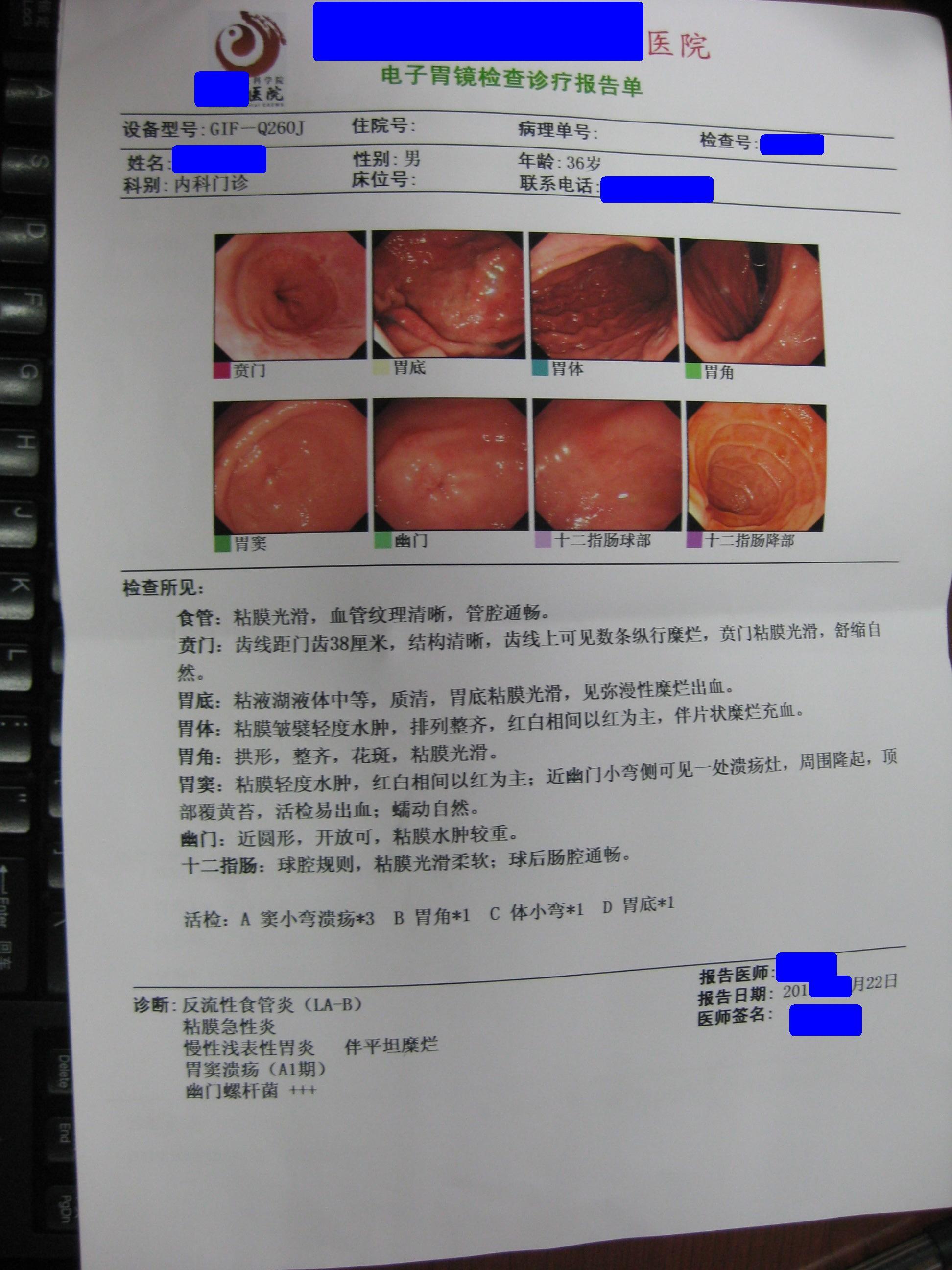 中西医合作幽门螺旋杆菌感染之序贯疗法 