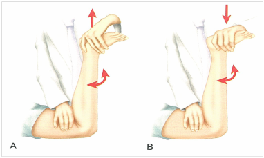 膝盖老是不舒服,是半月板损伤了吗?