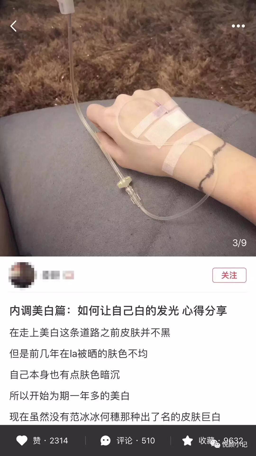 南光貴婦,鉑金美白?解密美白針的前世今生 - 好大夫在線