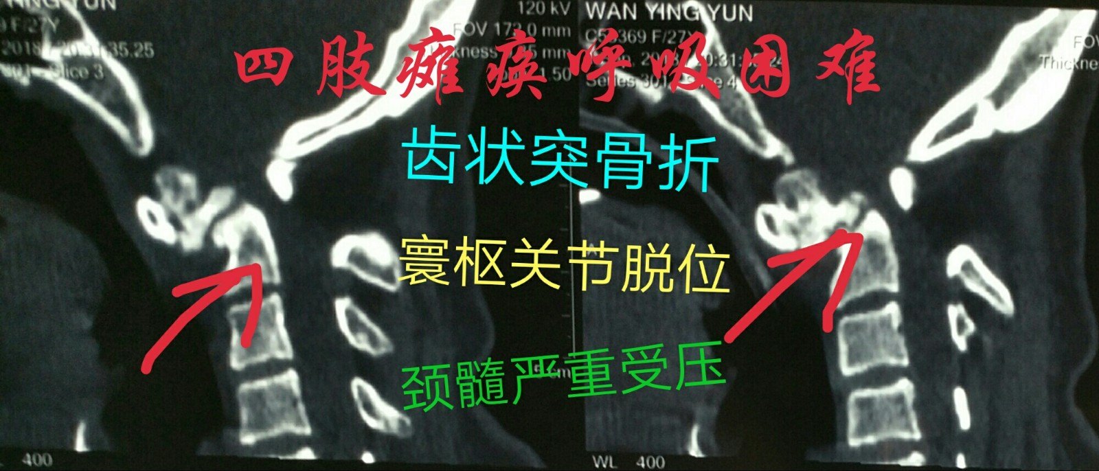 1540200591620149.jpg 3.JPG