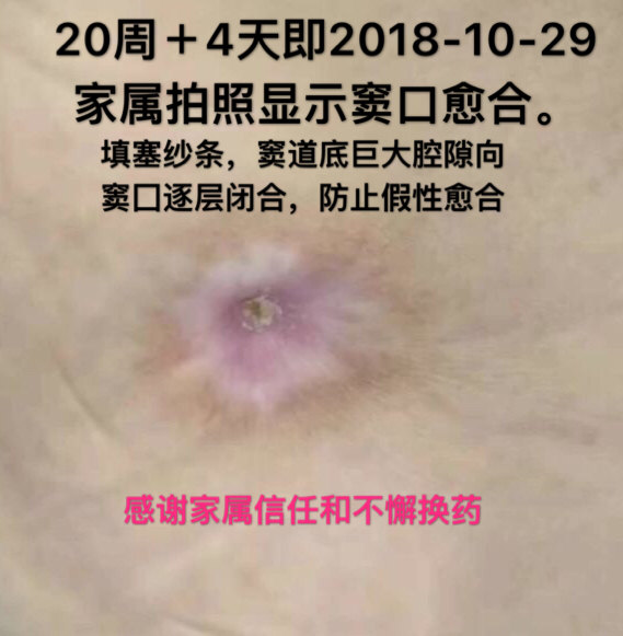 暂无