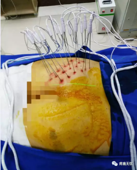 那些正在经历的尴尬的疼痛,难道真的没有办法了吗!