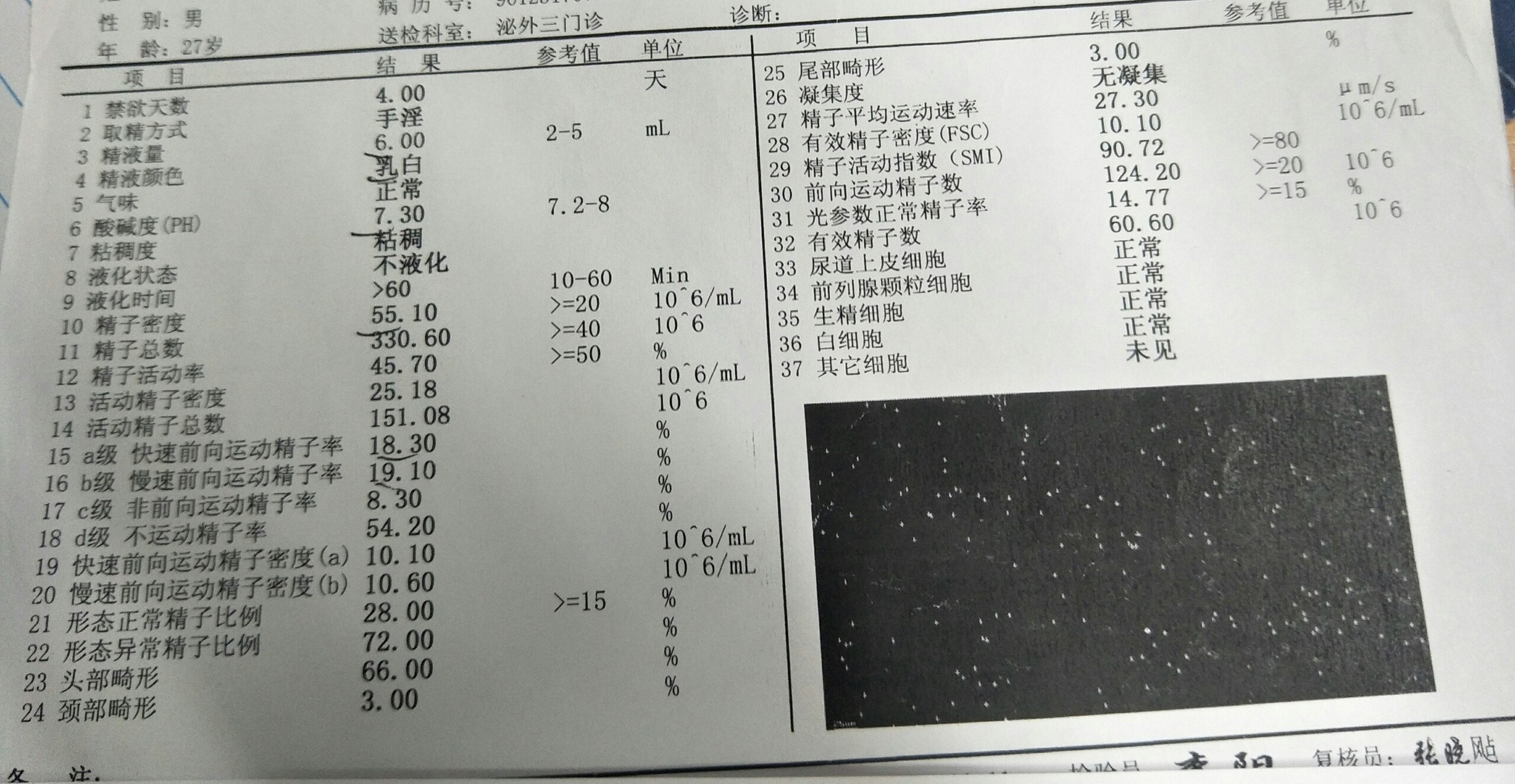 弱精症可以怀孕吗_弱精症_病因_日常护理_饮食运动_孕产_介绍_发病