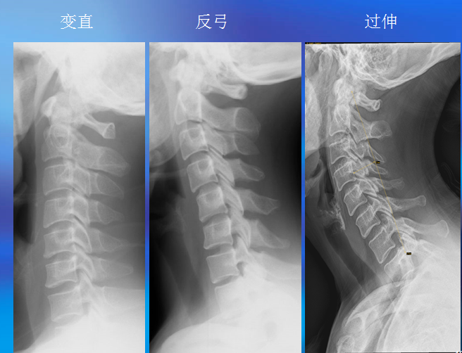 暂无