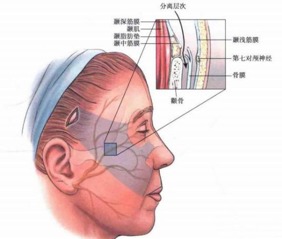 眼角轻度下垂,鼻唇沟加深,颊部皮肤轻度的堆积!