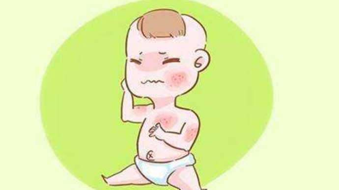 孩子得了特应性皮炎该如何护理