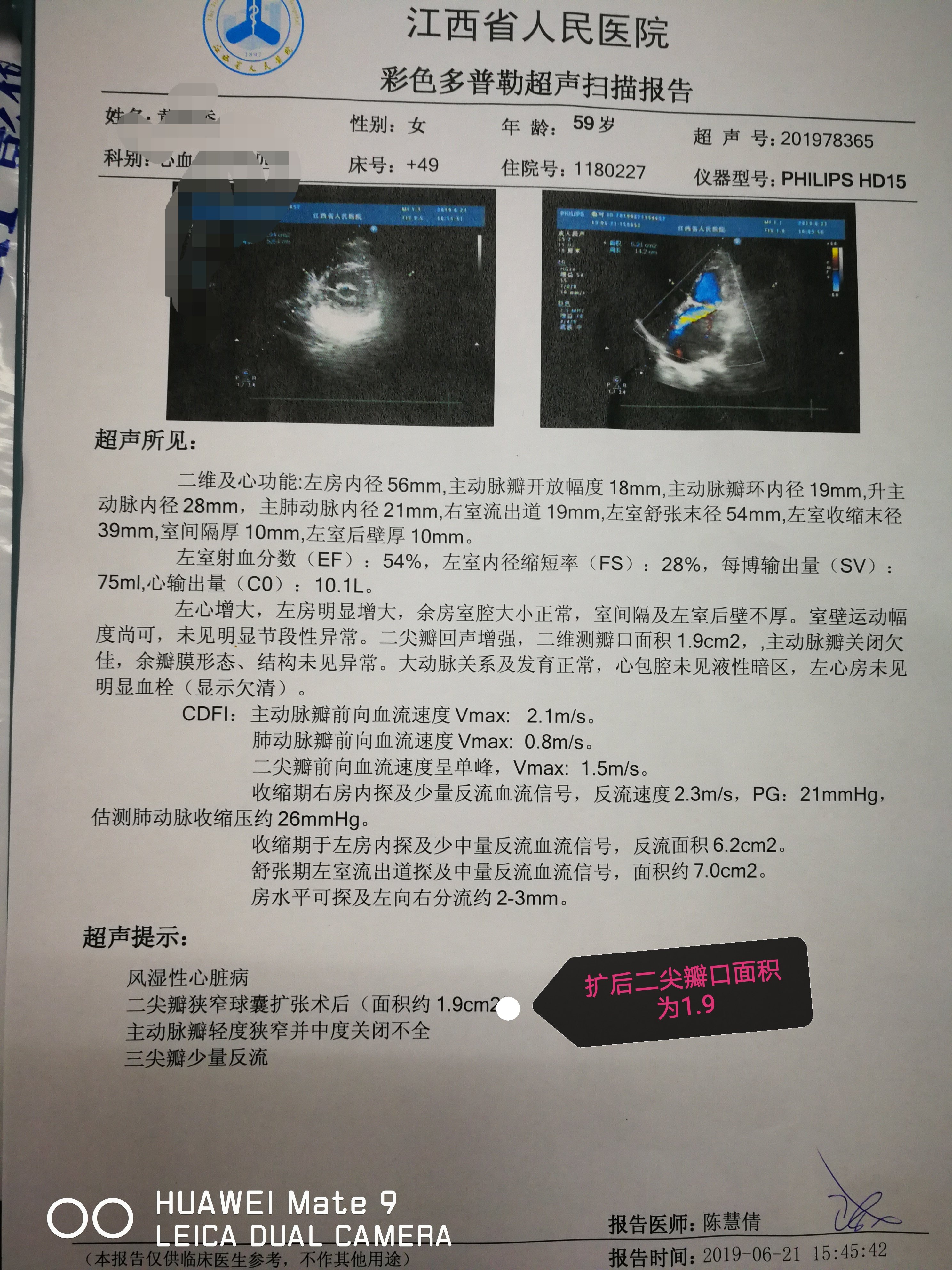 江西省风湿性心脏病二尖瓣狭窄