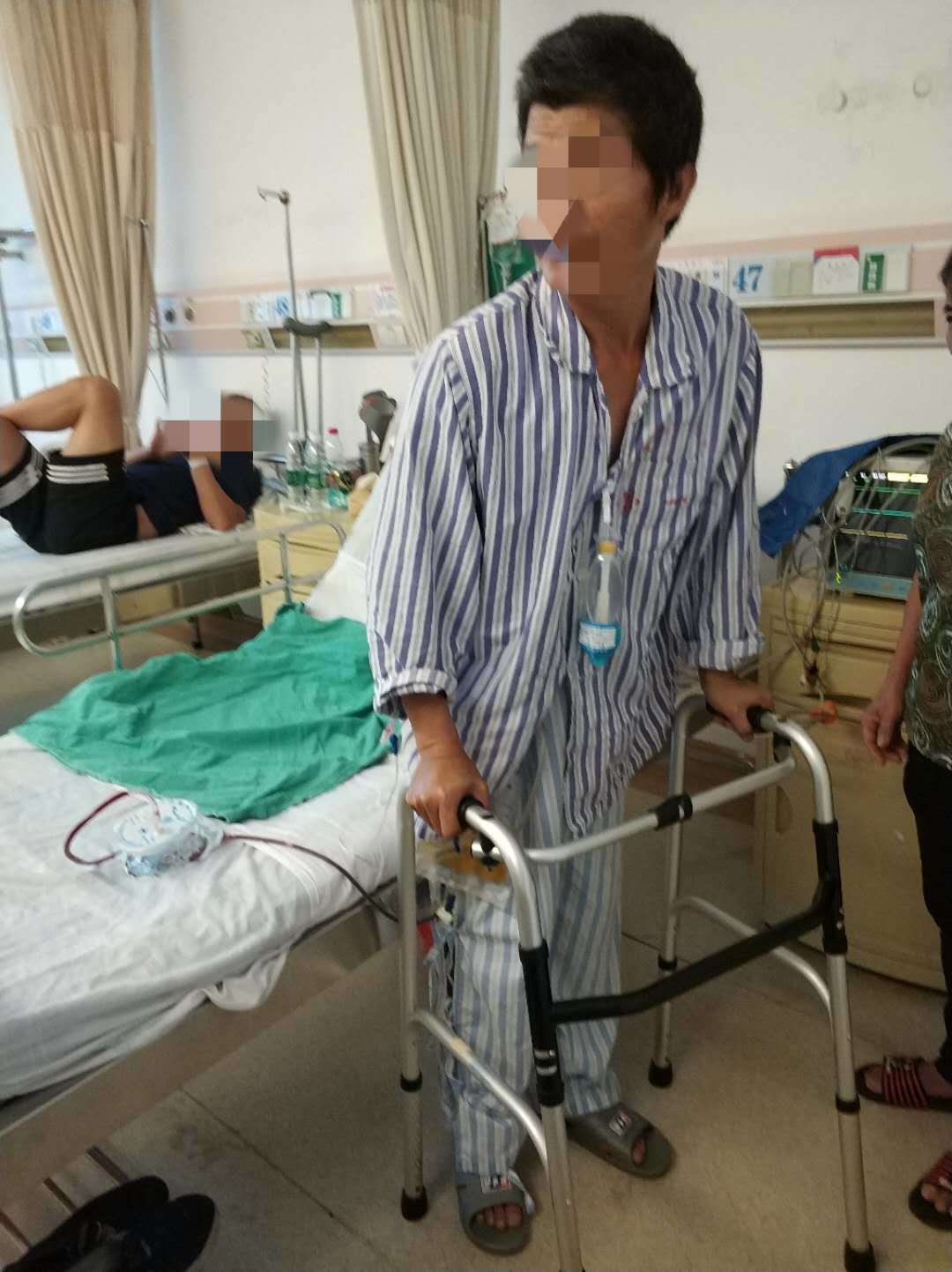 右髋关节置换手术后快速康复:股骨头坏死右侧全髋关节置换术后6小时无