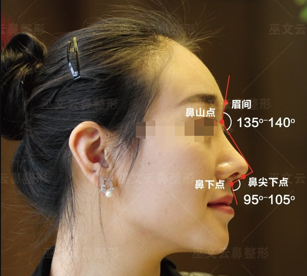 鼻唇角,鼻额角了解一下! - 好大夫在线