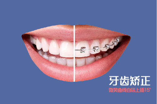 牙齿整形和矫正对人有什么影响吗