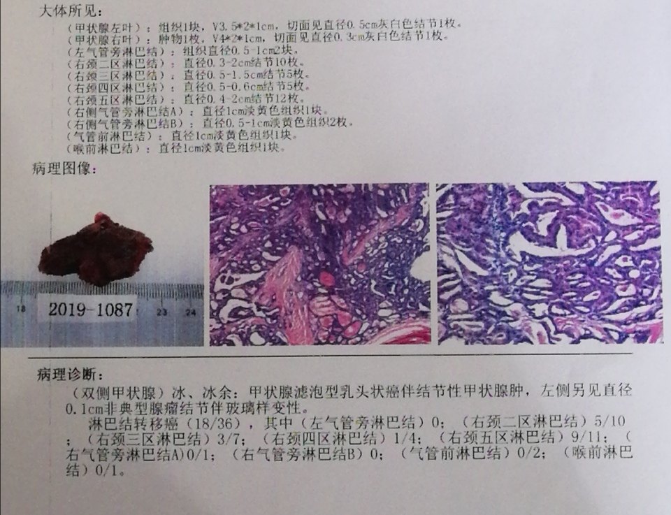 暂无