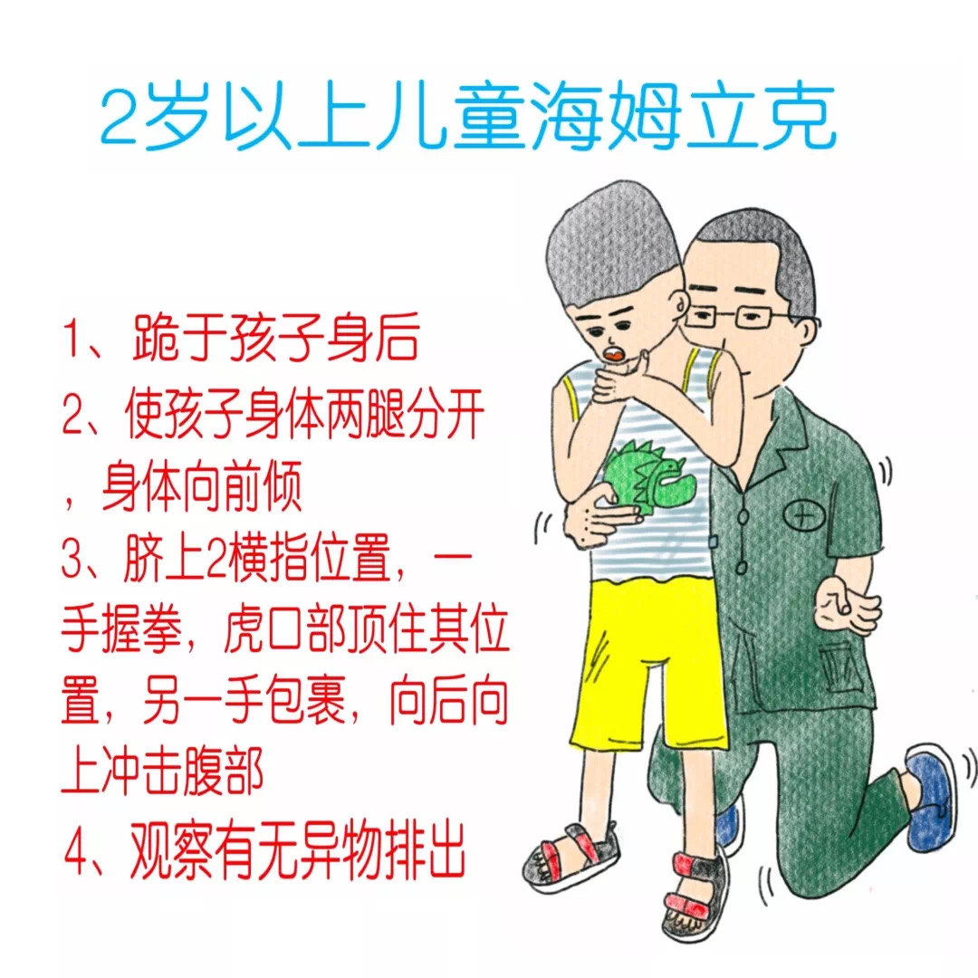 海姆立克腹部冲击法(heimlich maneuver)也称为海氏手技,是美国医生