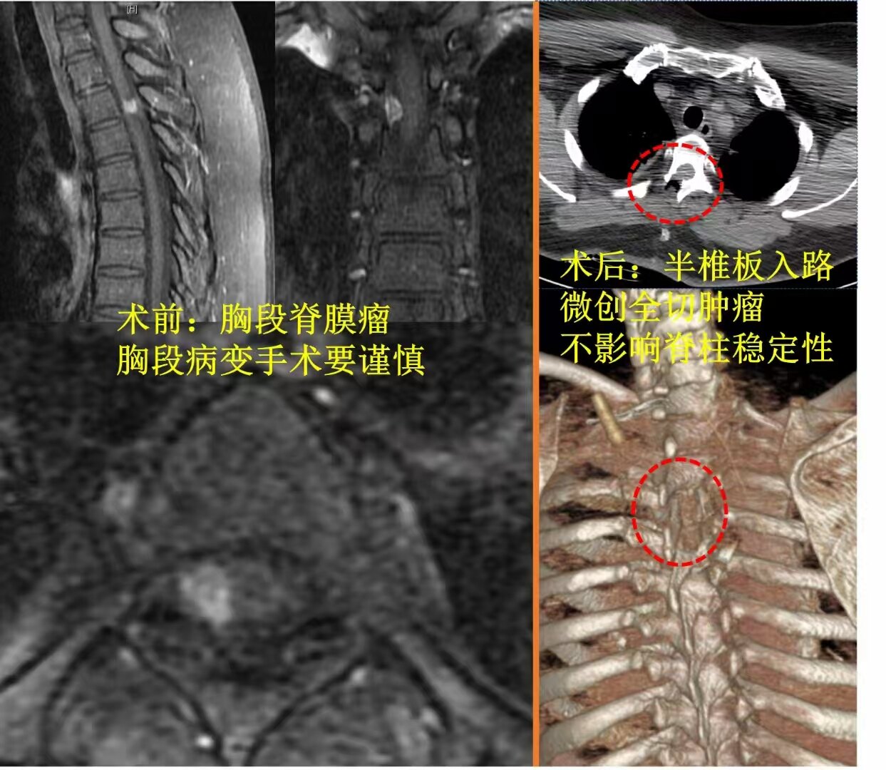 圖文圖片