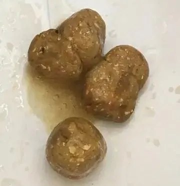 为宝宝便便抓狂的粑粑麻麻,看这篇文章就够了_小儿肠炎_介绍_相关疾病