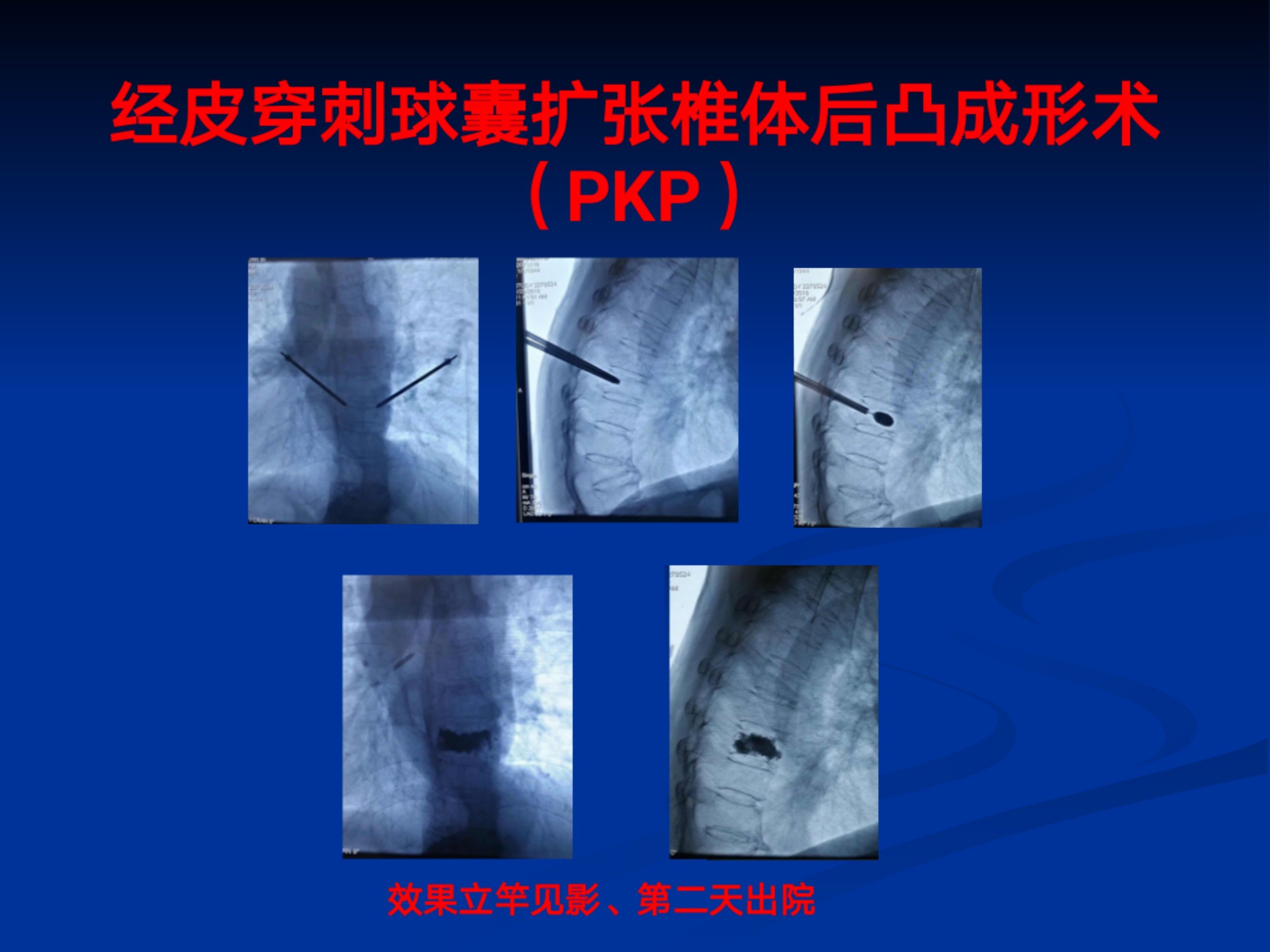 浅谈腰痛(1)_40.jpg