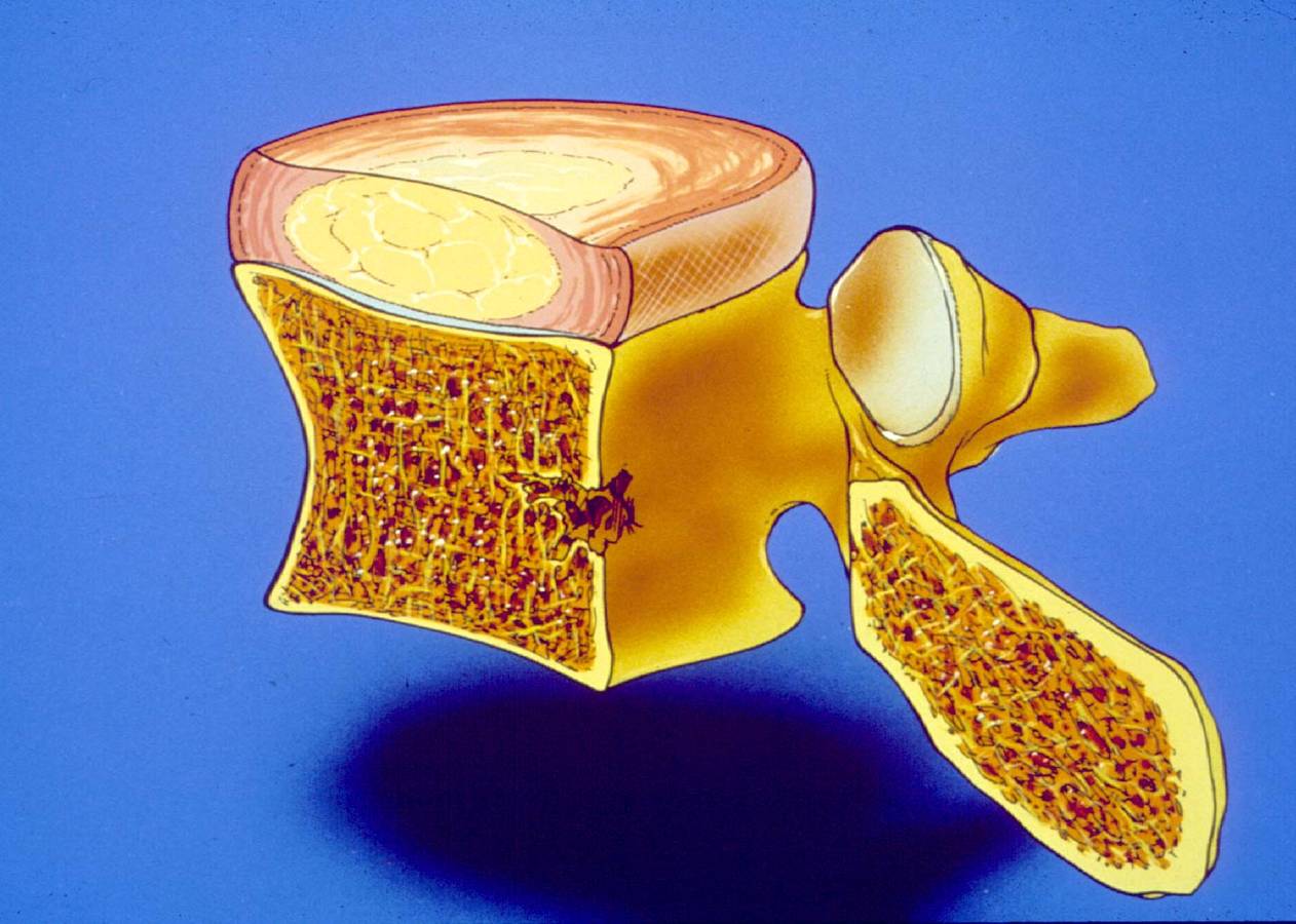 认识椎间盘 - 好大夫在线
