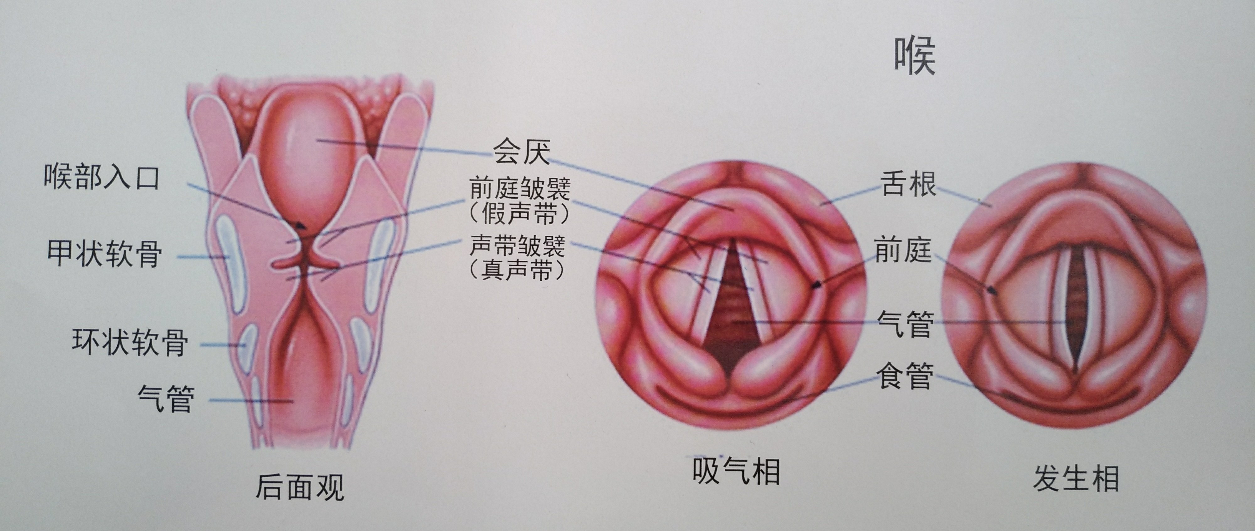 慢性喉炎
