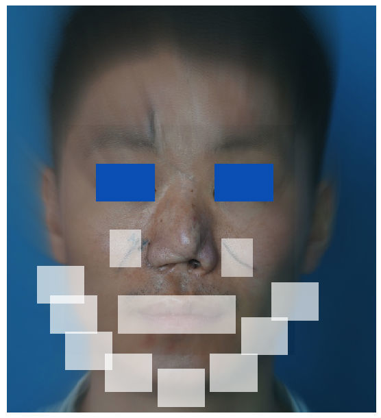 鼻再造的秘诀--破镜如何重圆?