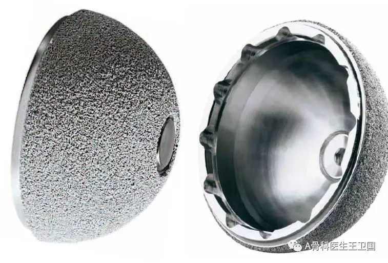 髋关节置换,用"陶瓷的"还是"塑料的"?